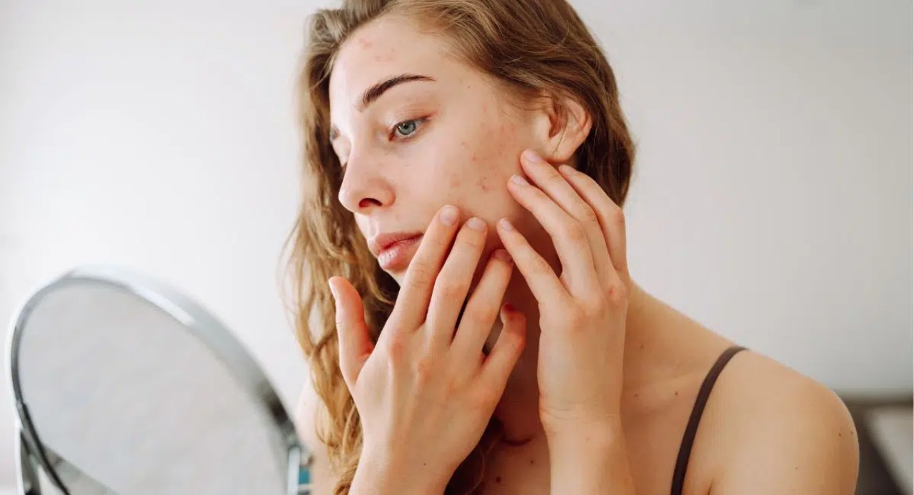 Caring for Skin After a Reaction